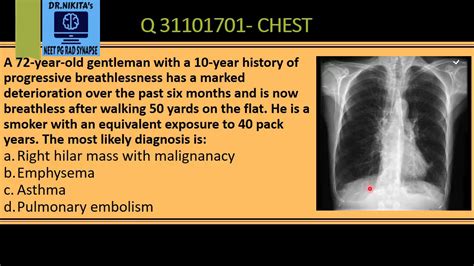 CHEST X RAY- EMPHYSEMA/ COPD SIGNS - YouTube