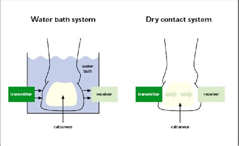 Figure 1 from Broadband Ultrasound Attenuation ( BUA ) | Semantic Scholar