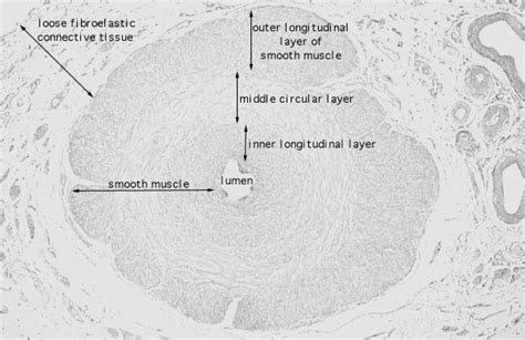 HLS [ Male Reproductive System, spermatic cord, ductus deferens] MED MAG labeled