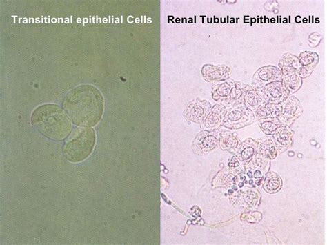 Renal Tubular Epithelial Cell - Google Search | Microbiology lab, Medical lab technician ...