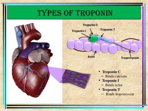 Cardiac troponin (Dr.Vishal)