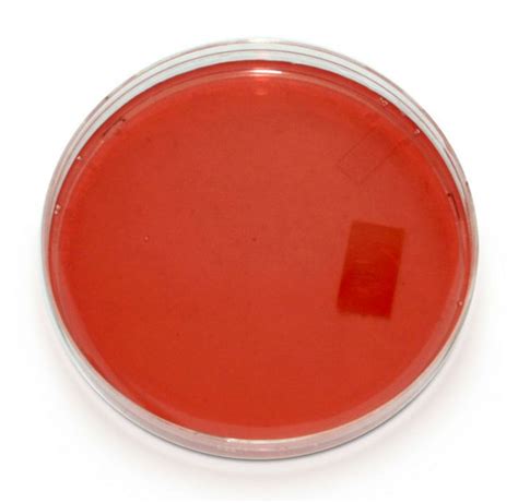 13 best images about MacConkey agar on Pinterest | Stains, Microbiology and Medium