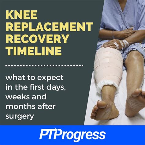 Knee Replacement Recovery Timeline: What to Expect