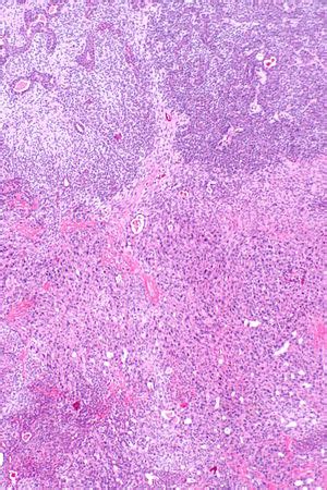 Quiz:Salivary gland 1 - Libre Pathology