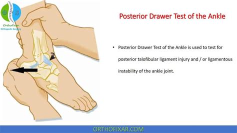 Posterior Drawer Test of the Ankle | Drawer test, Ligament injury, Ankle anatomy