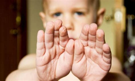 Why do your fingers wrinkle in the bath? It's all down to popping ...