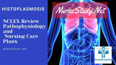 Histoplasmosis Nursing Diagnosis Care Plan - NurseStudy.Net