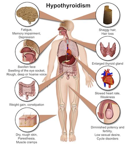 Signs of Thyroid Problems | TSC