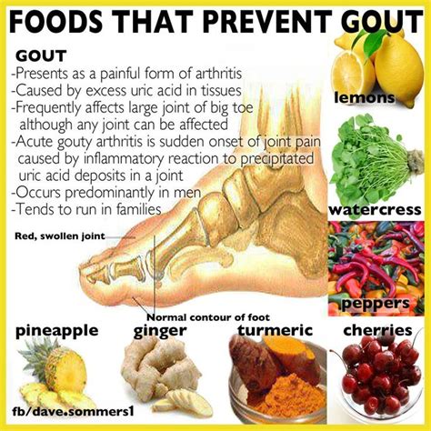 Prevent gout with these alkaline foods. | healthy stuff | Pinterest