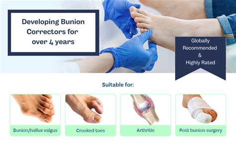 Caretras Bunion Corrector, Orthopedic Bunion Splint, Big Toe Separator Pain Relief, Non-Surgical ...