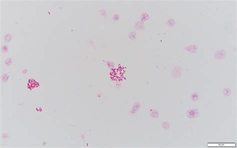 Chryseobacterium indologenes〔クリセオバクテリウム〕 | グラム染色: Gram Stain