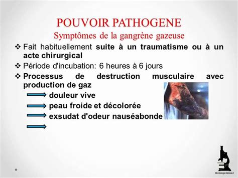 Clostridium perfringens | Clostridium perfringens