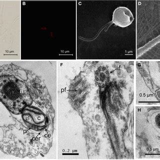 Morphology and ultrastructure of the flagellate. (A) Bright-field image... | Download Scientific ...