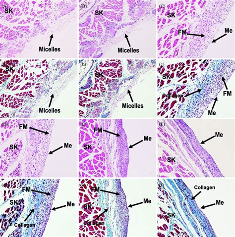 H&E (A) to (F) and Masson trichrome staining (a) to (f) of ...