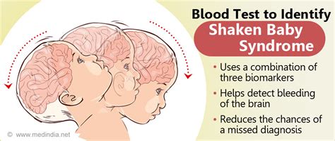 First Blood Test To Detect Shaken Baby Syndrome