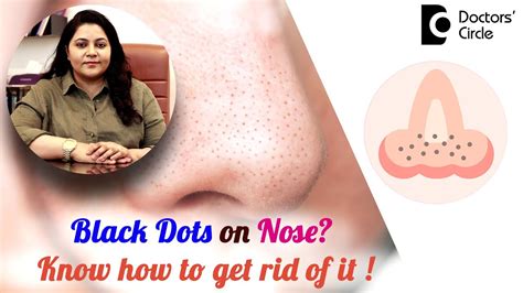 Black Dots on the Nose? Know how to treat them ! #blackhead - Dr.Tina ...