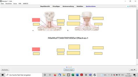 Image Occlusion Enhanced: ID and hiding boxes are shown on front - Add ...