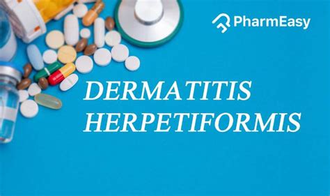 Dermatitis Herpetiformis: Causes, Treatment, And Management - PharmEasy Blog