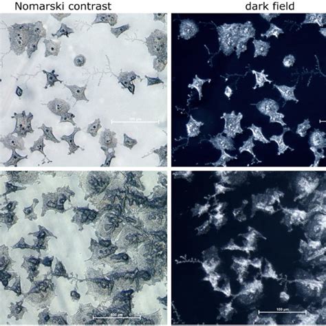 Visualization of morphology by Nomarski interference contrast ...