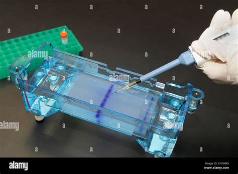 Dna Gel Electrophoresis Procedure