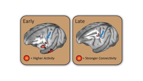 The Two Stages Of Brain Recovery - Asian Scientist Magazine