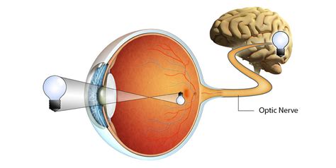 Self-Defined–Two Optic Nerves | Art+theBrain