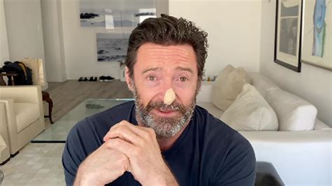 Hugh Jackman reveals skin cancer results | OverSixty