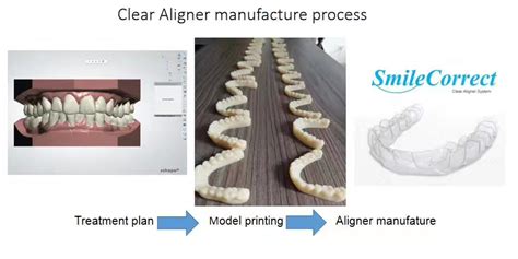 How we make Clear Aligner works? | China Orthodontic