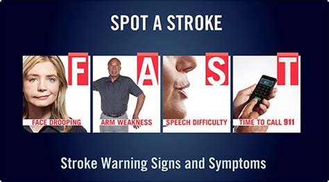 First aid for stroke symptoms - Frugal Nurse