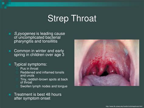 PPT - Streptococcus pyogenes PowerPoint Presentation, free download ...