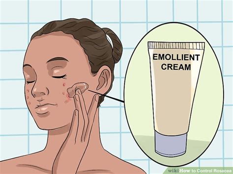 How to Control Rosacea: 15 Steps (with Pictures) - wikiHow