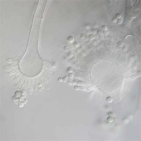 Sporometrics » Aspergillus Flavus Spores, Conidiophore