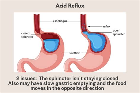 Acid Reflux In Dogs From a Chinese Medicine Perspective