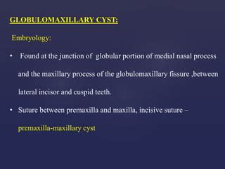 Globulomaxillary Cyst Histology