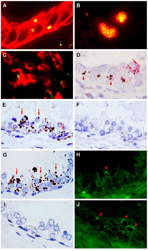 Characterization of P. acnes-positive cells and differentiation between ...