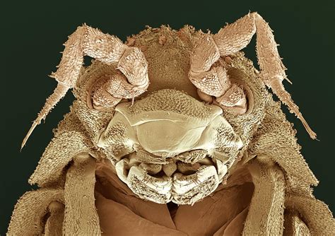 Woodlouse Head, Sem Photograph by Steve Gschmeissner