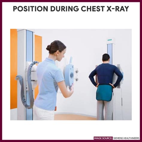 Chest X-ray (Chest Radiography) - Nursing Responsibilities - Nurseslabs