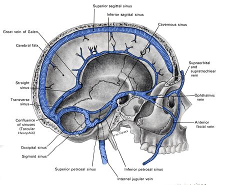 Dural Sinuses