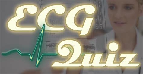 ECG Quiz – ECG Quiz