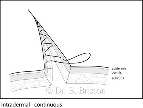 Intradermal Pattern – Veterinary Surgery Online