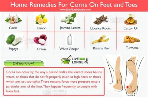 home remedies for corns | Home remedies, Natural home remedies, Remedies