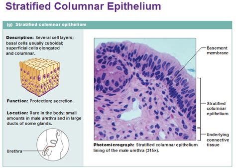 stratified columnar epithelium | Basic anatomy and physiology, Tissue ...