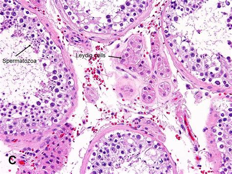 American Urological Association - Testis: Seminiferous Tubules and ...