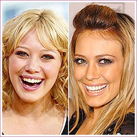 Scary Celebrity Plastic Surgery Before And After | Hilary Duff, Young And and Natural