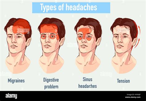 Different Types Of Headaches Different Types Of Headaches | Images and ...