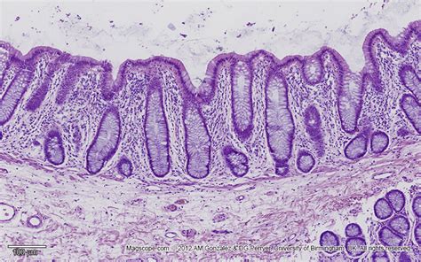 Low magnification image of the glandular epithelium of the gastric mucosa