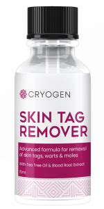 Cryogen Skin Tag Remover (Truth Exposed) Beware Before Buying!