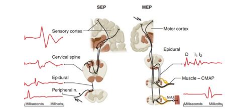 Evoked Potentials - Neurological System Monitors