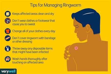 How Ringworm Is Treated