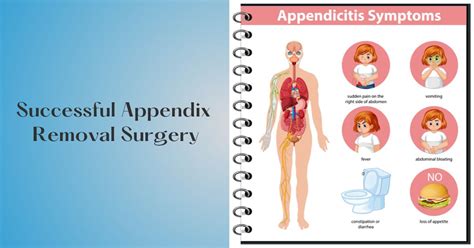 Appendix Removal Surgery - Costs and Symptoms of Appendicitis